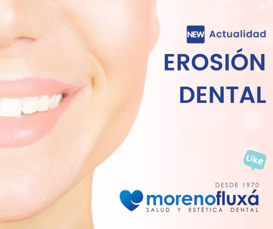 Erosión dental. Como prevenirla y tratarla.