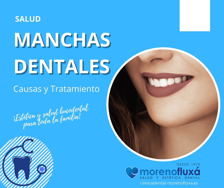 Manchas en los dientes, origen, tipos y tratamientos